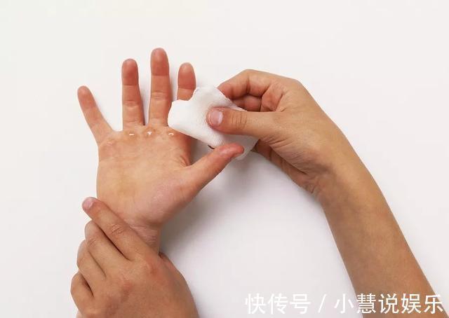 常识|孩子烫出水泡,要不要刺破烫伤高发期,基本急救常识要知道