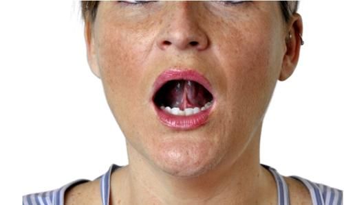 血脂|血脂高的人,头部容易有3种表现,或是脑梗的预兆,趁早进行检查