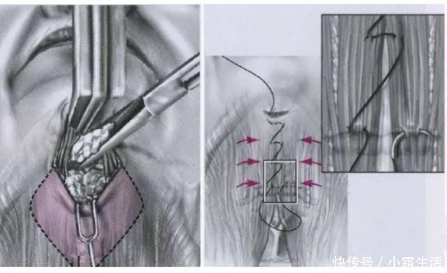 医生|脖子处皮肤松弛严重,皱纹明显!做哪些项目比较好?医生仔细盘点
