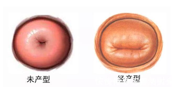 小秘密|困扰无数宝妈的问题:婚前有流产史,该向医生坦白吗?