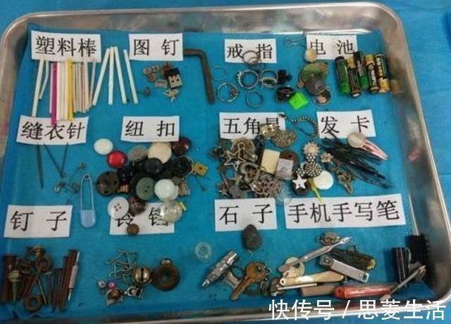 异物|4岁女孩误吞水银,奶奶却让娃先吃菜再送医,医生:姜还是老的辣