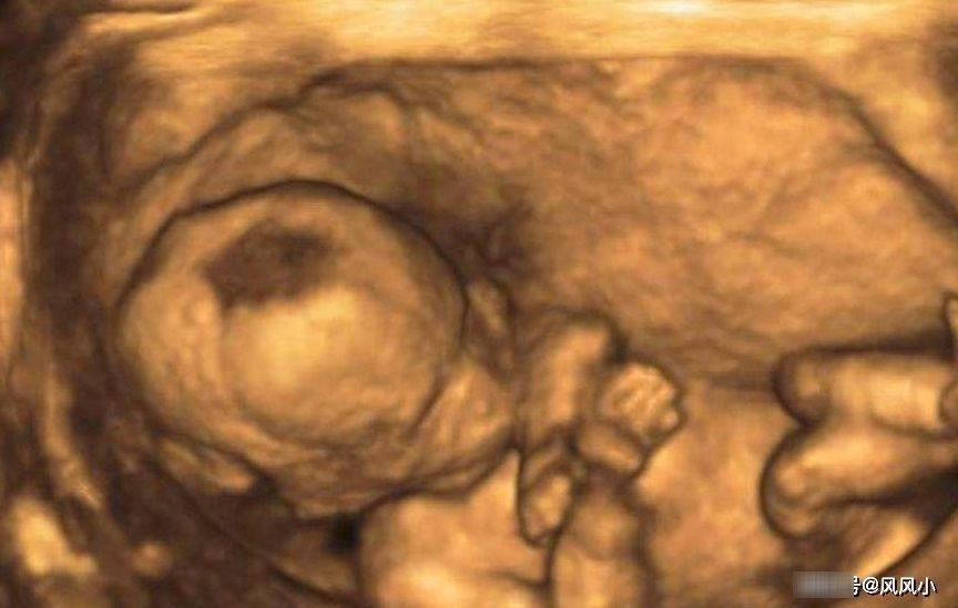 宝宝|做四维彩超前，这些事项孕妈最好知道，不然浪费钱，还会伤害宝宝