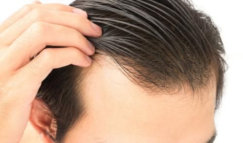 头发是从发根长，还是从发梢长？头发掉了，还会长出来吗？