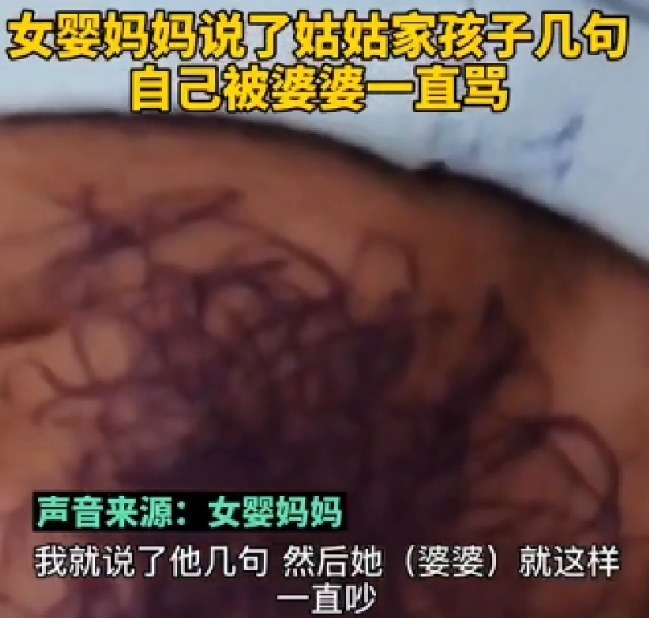 满月女婴遭亲戚孩子乱涂乱画,脸上全是墨水,亲戚:和孩子较啥劲