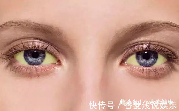 排毒|肝不好的人,头部会有4个异常,占了一个,也要注意养肝了