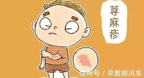 慢性荨麻疹|荨麻疹易反复发作,这三点对于改善夏季过敏反应有帮助