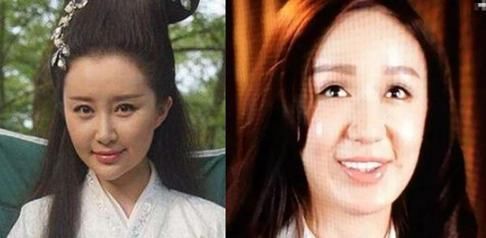 起点|中庭过长,和同龄人相比,有一种超出年龄的成熟和老气,怎么办