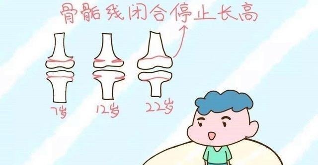 骨骺线|孩子身体如果有这三个迹象,很可能是要停止长高了,家长要留意!