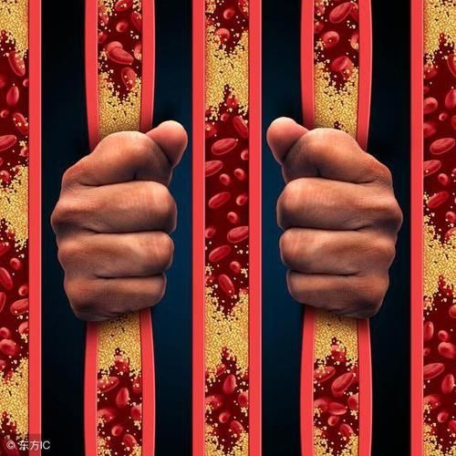 医生说:脑梗多是“吃”出来的,爱吃这3种食物的人,尽早做脑CT