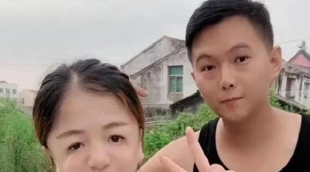 王女士|还记得那个25岁的“鸟脸妈妈”吗?孩子不幸遗传疾病,如今怎样