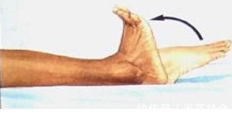 专家|血管堵塞导致血栓,专家每天坚持做两个动作,全身血液通畅