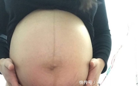 形状|孕囊形状可以察男女？孕囊形状受它影响，别疏忽