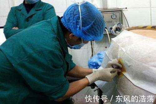 切口|剖腹产的“竖切”与“横切”有何区别?大夫说了答案,孕妈别选错