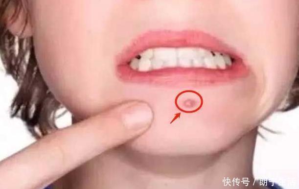 消炎|女性患有妇科炎病脸上多有3大变化,常喝1杯水,抑菌消炎养子宫