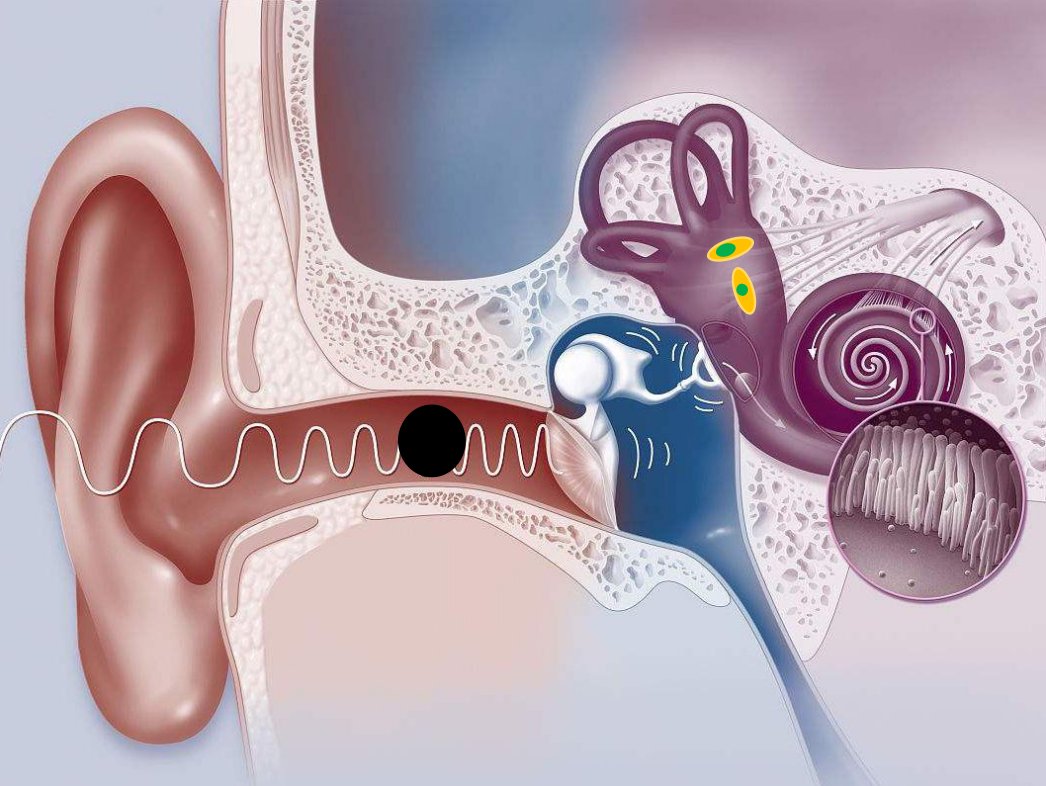 你知道吗？眩晕可能要看耳鼻喉科|科普 | 耳石器