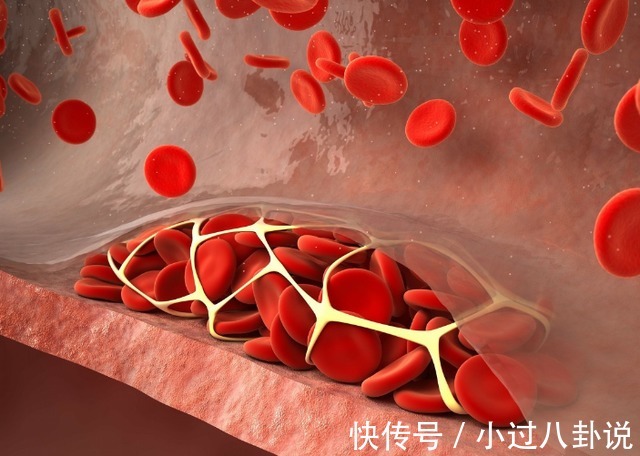 不吃早餐|蹲久了站起来就头晕?别大意,可能是3种疾病在作祟