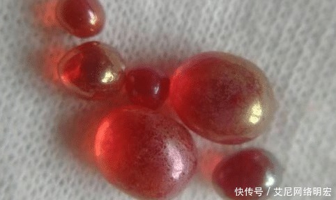 舍利子|舍利子是什么?高僧火化的时候才有,普通人为何没有呢?