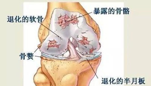 强健|下蹲五分钟等于步行一小时，长寿强健的最好锻炼方法!