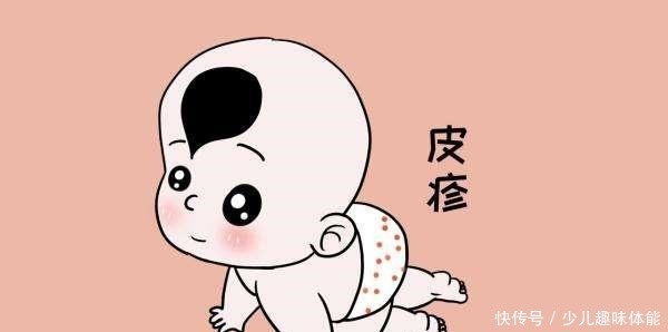 发烧|孩子们生病的4大症状,家长切勿大意,对孩子们会造成很大的伤害!