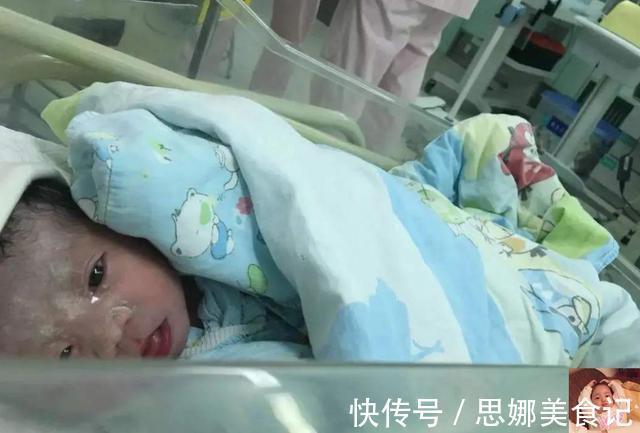 小雪人|妻子生下“小雪人”宝宝,陪产丈夫看到后连忙解释:和我没关系