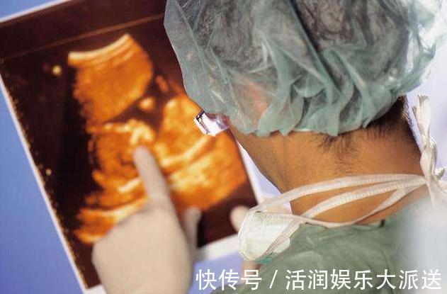 胆汁淤积|年轻孕妈做四维彩超,一看画面医生笑出声,孕妈羞红脸尽干坏事