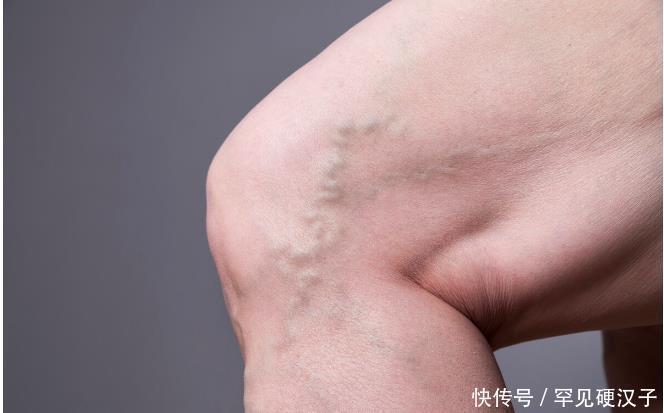 身体|身体开始衰老腿部有征兆出现4个症状要警惕,说明你开始老了