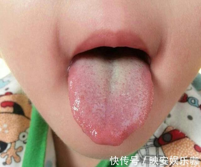 食物|孩子积食饿两顿就好?别被忽悠了,养娃牢记这3点,让娃远离积食