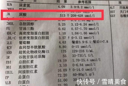 嘌呤|尿酸高于420走不了路医生劝告1食物若还吃，痛风早晚找上