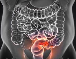 狭窄者|做肠镜的好处有哪些？提醒：以下“3类”人群或不适合做肠镜检查