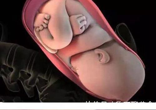 子宫破裂|“顺产再好,我也不选”,95后孕妈给出的理由,让人很难反驳