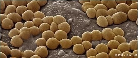 菌落|8岁小孩出去玩,回家不洗手按了个手印,妈妈培养48小时后