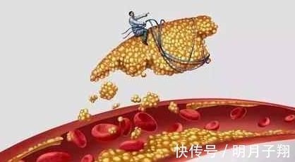 清洁工|血液太稠，担心高血脂，它们被称为血液清洁工，赶走血液里的垃圾