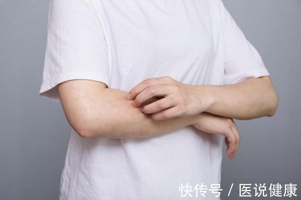 皮肤|秋季干燥,会对皮肤造成3种影响?教你3招,或能有效保护皮肤