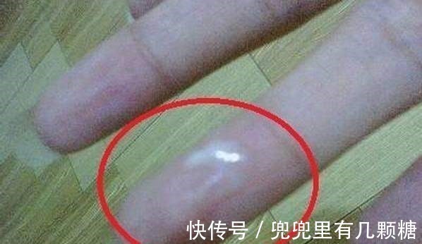 出血|有没有妇科病, 看这3个标准, 如果你全满足, 恭喜, 你还算健康!