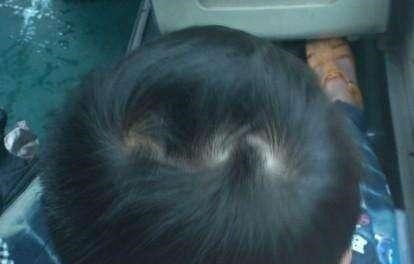 父母|为什么有的孩子头上有“2个旋”代表什么意思,父母要知道!