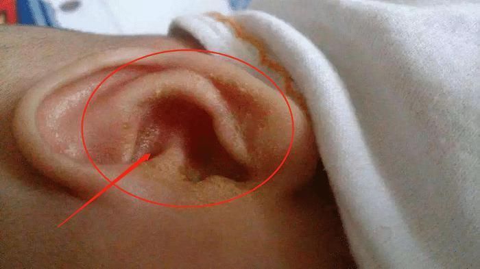 孩子|2岁儿子总摸头,妈妈觉得不对劲带娃去检查,医生感叹幸亏发现早