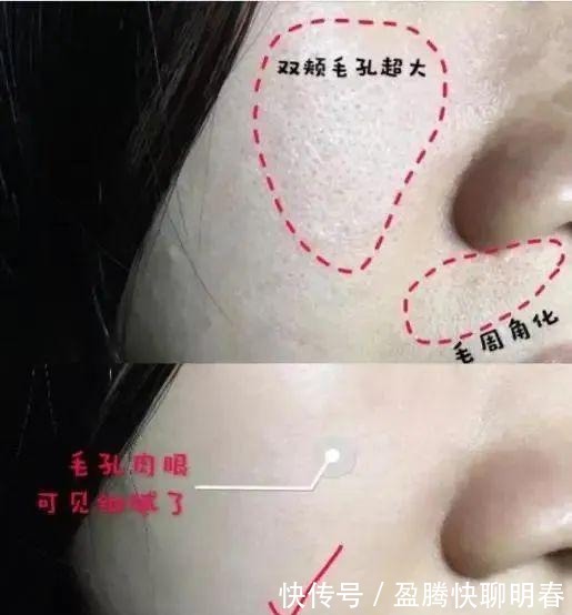 薇娅|能让李佳琦和薇娅看得上,这韩国去角质凝胶,实力真的很强大