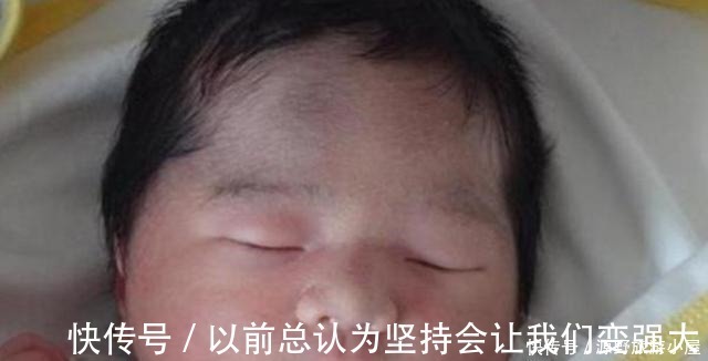 单眼皮|宝宝出生后一直不睁眼,爸妈赶紧把孩子送去了医院,医生看乐了