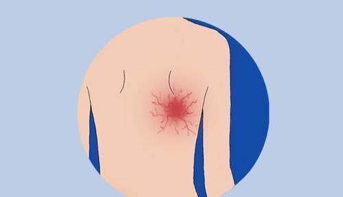 癌症|体内有癌，身体会释放出哪些信号注意观察，别拖到晚期才重视