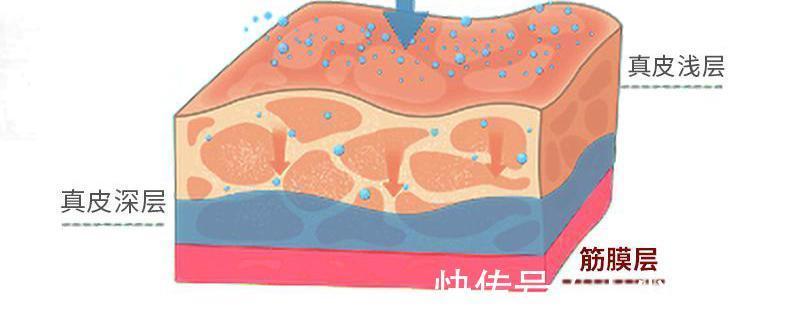 除皱|王小民教授:做小拉皮的人逐渐增多,网上传言却没有效果?