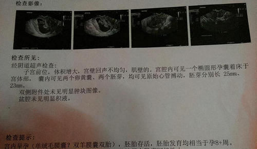 孕酮|确定怀孕后，第一次产检是在什么时候？超过这个时间，就晚了