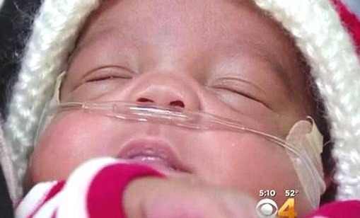 重症监护室|女子生完头胎仅9个月二胎出生,在此之前竟不知道又怀孕了