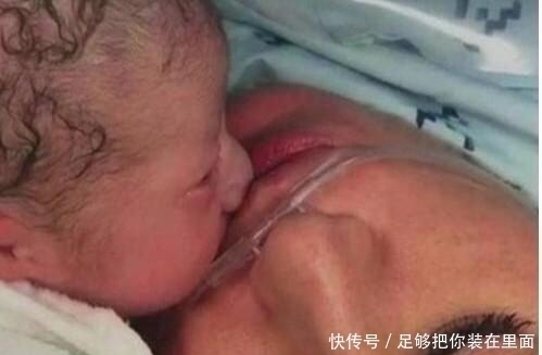 妈妈|剖腹产生宝宝时要让产妇亲吻宝宝?别小看这个环节,有这四个意义
