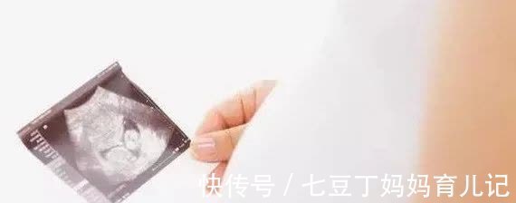 宝妈|不做唐筛，直接做无创DNA可以吗？