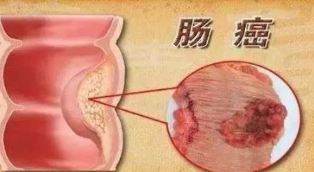 8种癌都＂怕＂这种菜！但99%的人都吃错了，配上它，营养翻倍~