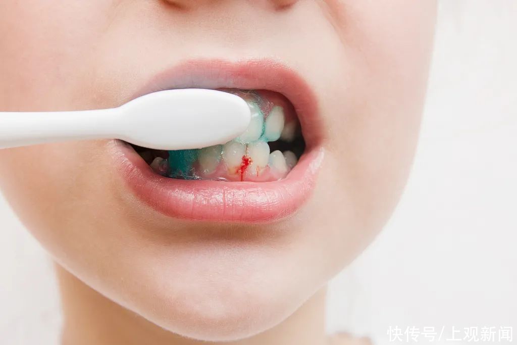 电动牙刷|电动牙刷和普通牙刷怎么选？正确的刷牙姿势了解一下→