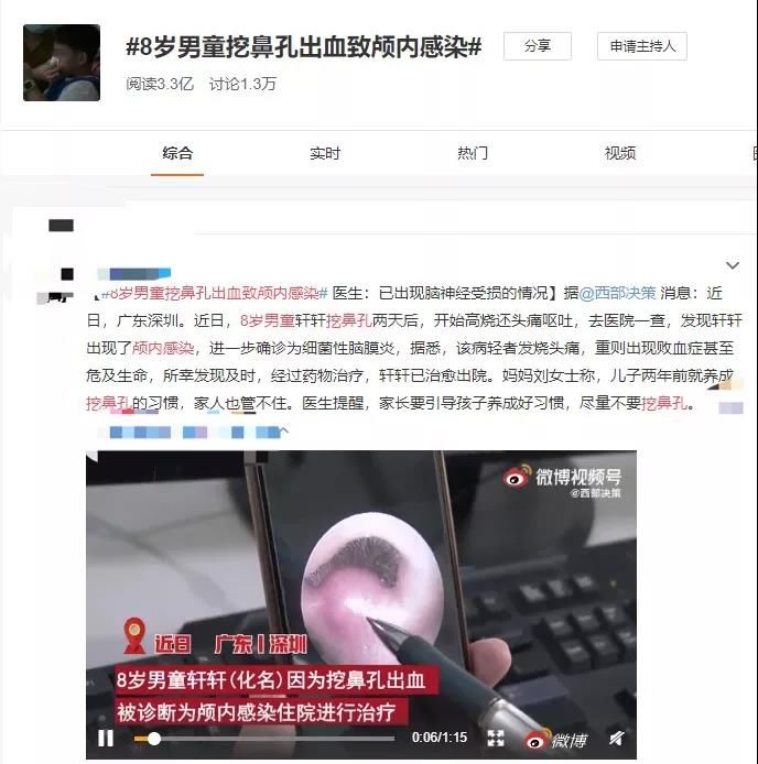 流鼻血|快住手!鼻孔千万不要随便抠,一男童竟因此致颅内感染!赶紧告诉家里人