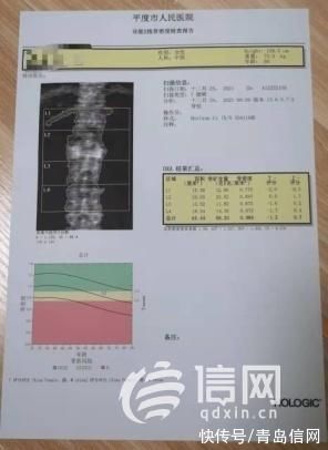 骨骼|平度人民医院引进新设备 双能X线骨密度测定仪全面评估