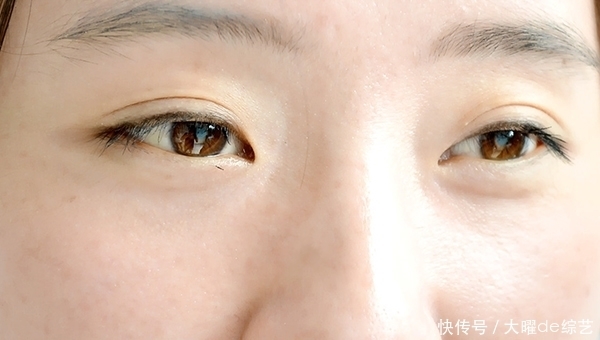 补水|女性45岁后，脸上的斑点丛生，可以通过饮食调理吗？怎么做？