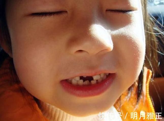 智齿|6岁男娃长“双层牙”,老人的“坏习惯”害了娃,你家有这习惯吗